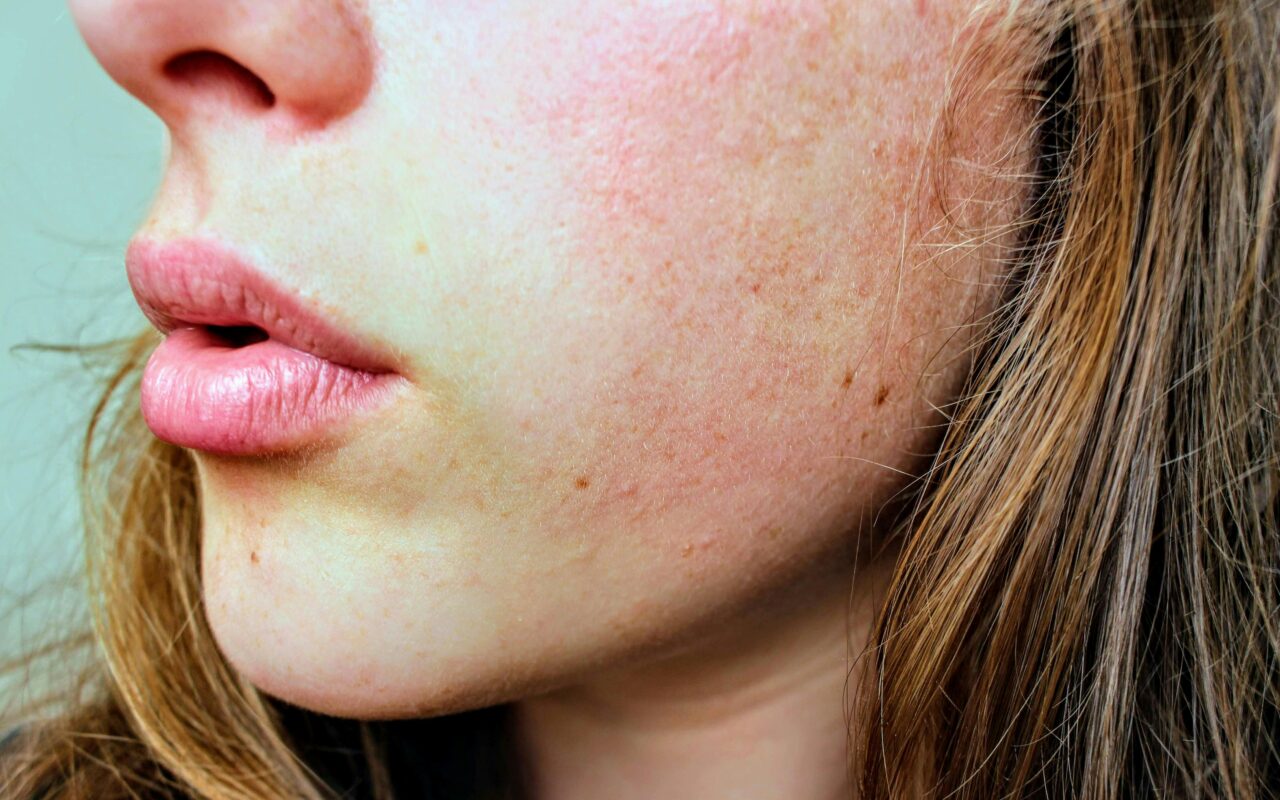 Detailed close-up of a woman's facial skin showing natural texture and complexion.